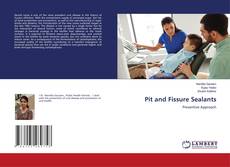 Copertina di Pit and Fissure Sealants