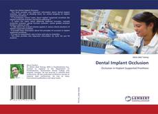 Copertina di Dental Implant Occlusion