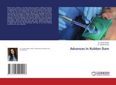 Copertina di Advances in Rubber Dam