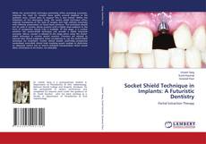 Copertina di Socket Shield Technique in Implants: A Futuristic Dentistry