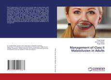 Copertina di Management of Class II Malocclusion in Adults