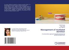 Copertina di Management of mutilated dentition