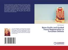 Обложка Bone Grafts and Guided Tissue Regeneration in Furcation Defects