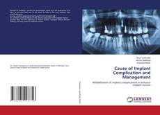 Copertina di Cause of Implant Complication and Management
