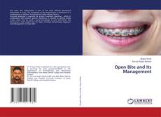 Buchcover von Open Bite and Its Management
