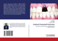 Copertina di Implant Protected Occlusion