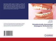 Copertina di Periodontically Accerelated Osteogenic Orthodontics