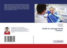Bookcover of Guide to manage tooth fracture