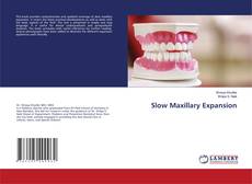 Bookcover of Slow Maxillary Expansion