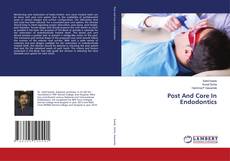 Buchcover von Post And Core In Endodontics