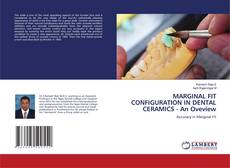 Buchcover von MARGINAL FIT CONFIGURATION IN DENTAL CERAMICS - An Oveview
