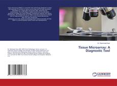 Buchcover von Tissue Microarray: A Diagnostic Tool