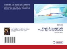 Buchcover von N butyl-2-cyanoacrylate Versus Conventional suture