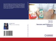Copertina di Success and Failure in Implant