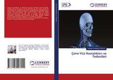 Buchcover von Çene-Yüz Hastalıkları ve Tedavileri