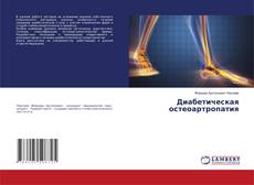 Buchcover von Диабетическая остеоартропатия