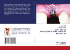 Buchcover von SOFT TISSUE AUGMENTATION IN IMPLANT DENTISTRY