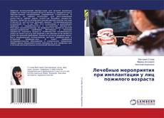 Buchcover von Лечебные мероприятия при имплантации у лиц пожилого возраста
