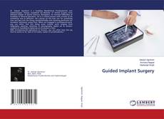 Copertina di Guided Implant Surgery