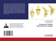 Buchcover von Congenital Talipes Equinovarus in Egypt