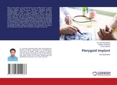 Buchcover von Pterygoid Implant