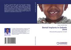 Buchcover von Dental Implants In Esthetic Zone