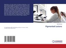 Buchcover von Pigmented Lesions
