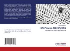Copertina di ROOT CANAL PERFORATION
