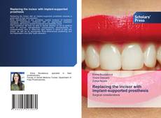 Обложка Replacing the incisor with implant-supported prosthesis