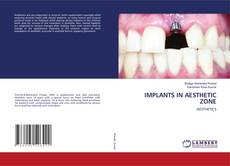 Copertina di IMPLANTS IN AESTHETIC ZONE