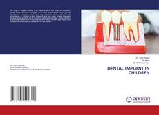 DENTAL IMPLANT IN CHILDREN的封面