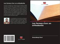 Bookcover of Les formes d'arc en orthodontie