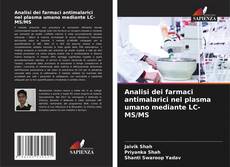 Bookcover of Analisi dei farmaci antimalarici nel plasma umano mediante LC-MS/MS