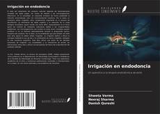 Bookcover of Irrigación en endodoncia