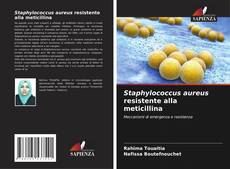 Couverture de Staphylococcus aureus resistente alla meticillina