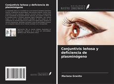 Buchcover von Conjuntivis leñosa y deficiencia de plasminógeno