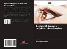 Conjonctif ligneux et déficit en plasminogène的封面