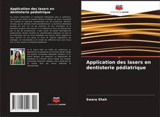 Buchcover von Application des lasers en dentisterie pédiatrique