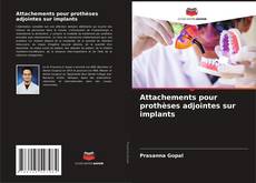 Buchcover von Attachements pour prothèses adjointes sur implants