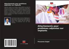 Copertina di Attachements pour prothèses adjointes sur implants