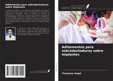 Bookcover of Aditamentos para sobredentaduras sobre implantes