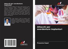 Bookcover of Attacchi per overdenture implantari