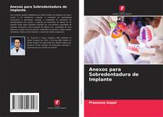 Buchcover von Anexos para Sobredentadura de Implante