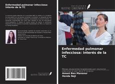 Enfermedad pulmonar infecciosa: interés de la TC kitap kapağı