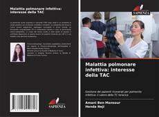 Bookcover of Malattia polmonare infettiva: interesse della TAC