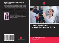 Bookcover of Doença pulmonar infecciosa: o valor do CT