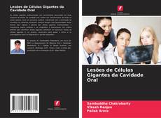 Bookcover of Lesões de Células Gigantes da Cavidade Oral