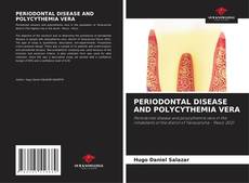 Bookcover of PERIODONTAL DISEASE AND POLYCYTHEMIA VERA
