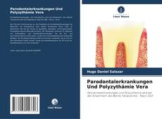 Обложка Parodontalerkrankungen Und Polyzythämie Vera