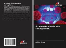 Bookcover of Il cancro orale e la sua sorveglianza